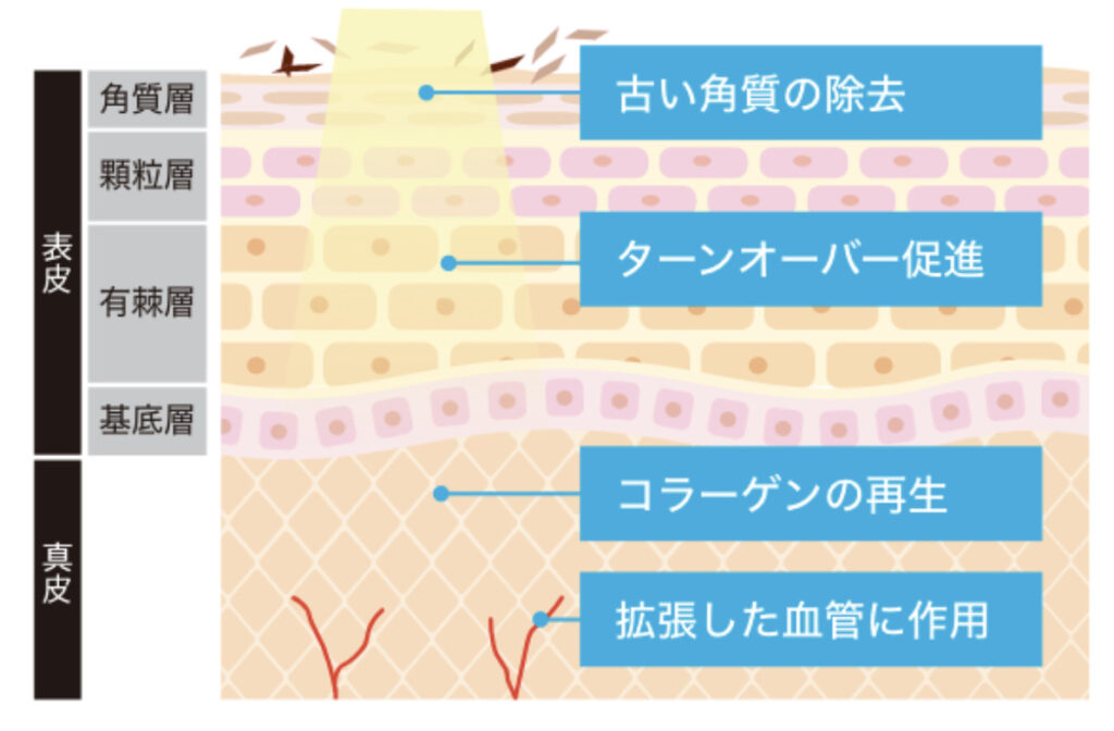 GENESISラストライヴ-大宮駅前店ブログ-オーダースーツSADA