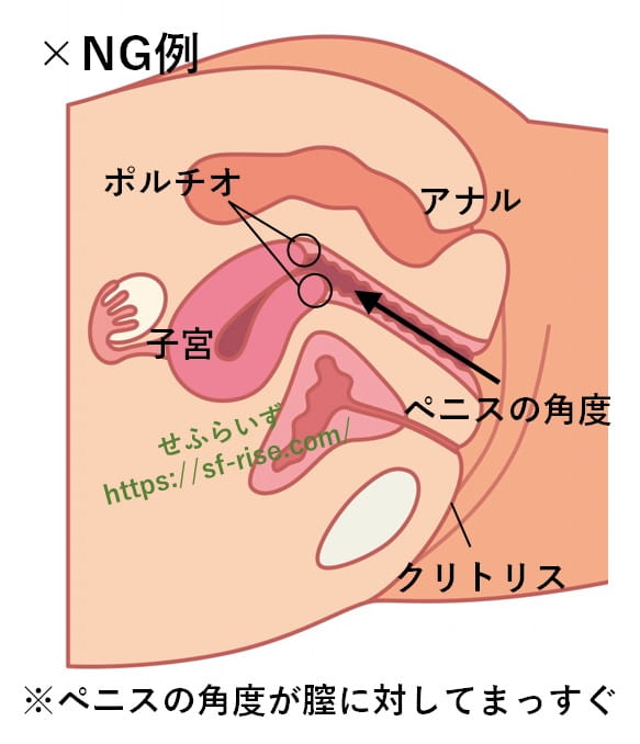 成人向け(R-18)】肛門挿入時の断面図作成依頼 | SKIMA（スキマ）