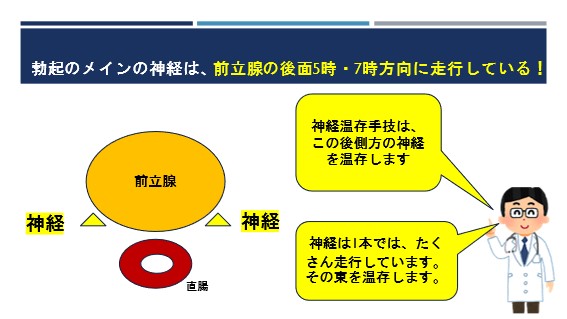 前立腺癌とEDの関係 – ED治療のリブラクリニック