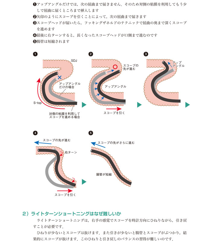 Amazon.co.jp: 304ステンレススチールスクリュートゥーススリーブワイヤースレッド修理保護コイルドヘリカルスリーブ  M1.6M2M3M4M5M6〜M24スレッド挿入a2