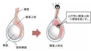 腎臓のあたりが痛む | 日本泌尿器科学会