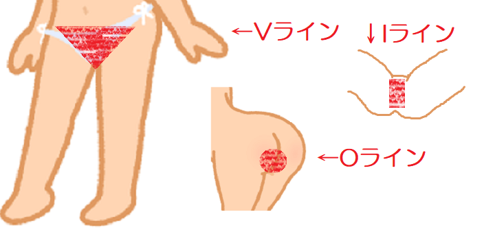 男性がパイパンにする陰毛処理のやり方を紹介 | メンズ脱毛百科事典 リンクスペディア