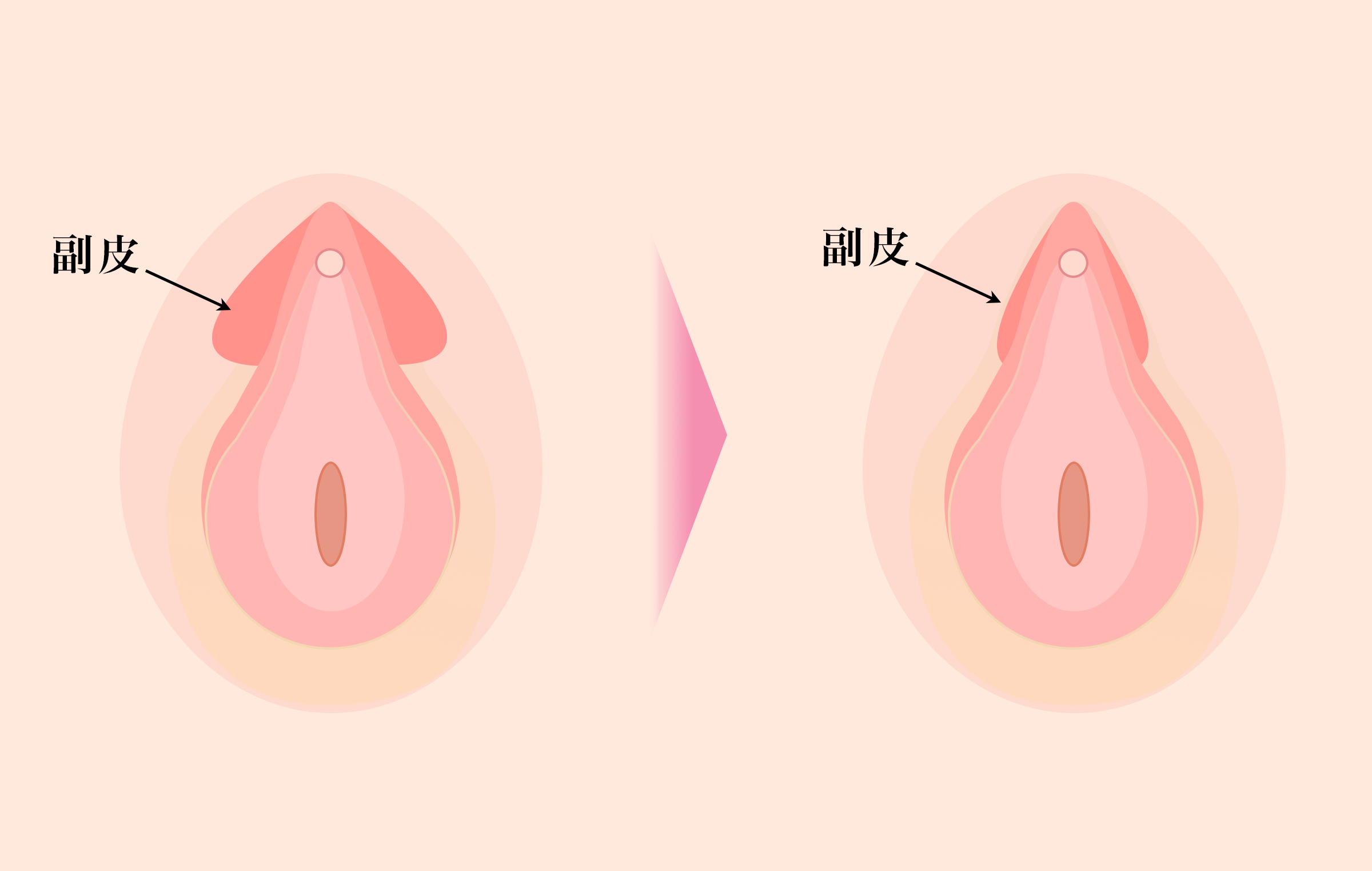 クリトリスの場所はどこ？構造・役割と快感を感じるためのいじり方 | Ray(レイ)