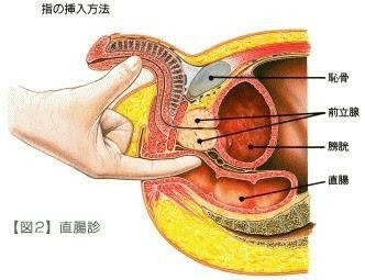 前立腺責めのやり方とコツ！気持ちいい前立腺マッサージの方法をイラストで解説