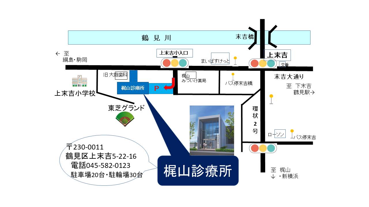 横浜の大動脈「環状2号線」川崎市内でなぜブツ切れ？ 接続道路が