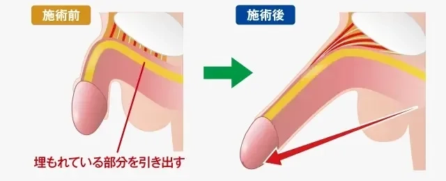 巨根・デカチンの男性だけが悩むデメリットと知られざるメリット１０選 - 東京裏スポ体験記