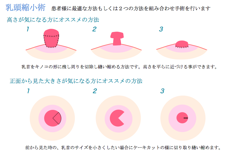 高校生男子です僕の乳首大きくないですか？別にいじったりはしてい - Yahoo!知恵袋