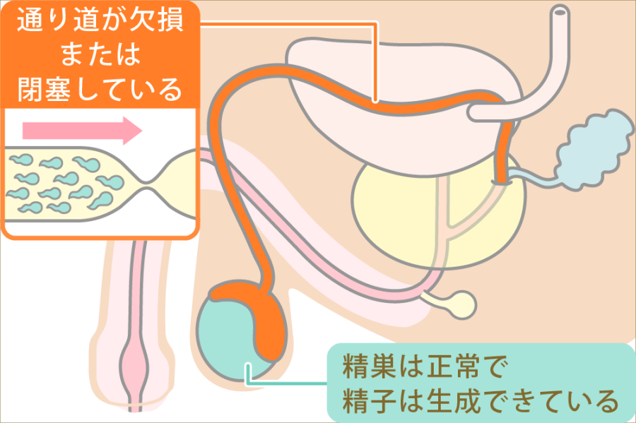 精液を大量に出しすために！ドピュっと発射する快感を味わおう！ | happy-travel[ハッピートラベル]