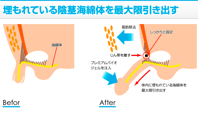 ワナ靭帯を伸ばして埋もれてるチンコを2cm増大させる方法 | イケオジの嗜み