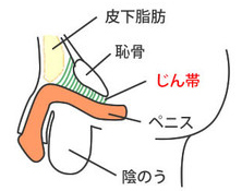 泌尿器科専門医 ドクター尾上の医療ブログ: 【性器の悩み】