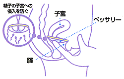 【外し方とその後も大事】コンドームの扱い方を深掘りしてみました！