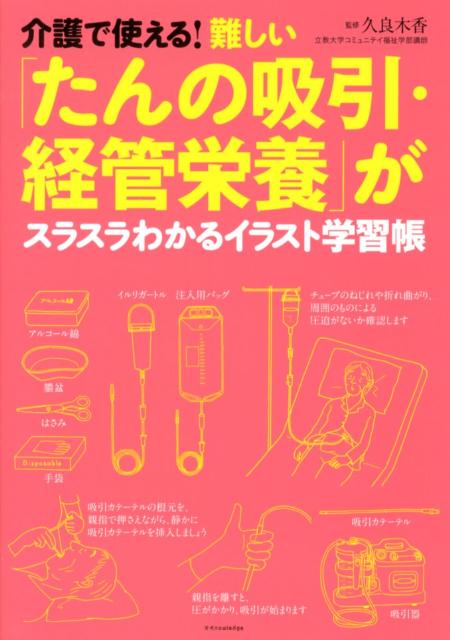 インプラントを腕に挿入するだけで… 避妊を巡る米国の今 | 山本佳奈の健康ナビ |