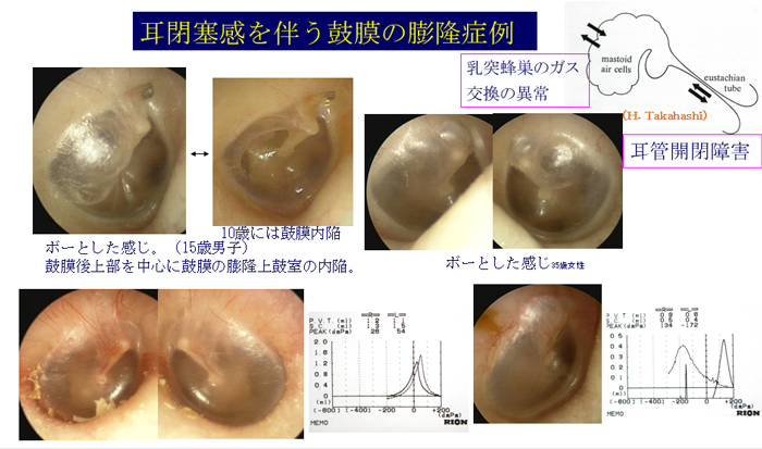 2人とも耳が性感帯の耳責め五悠 五が耳が弱いことを知って調子に乗ってから.. |