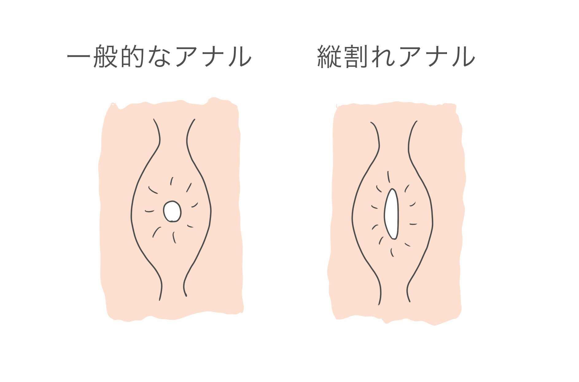 君はソレを我慢できない。 - 同人誌