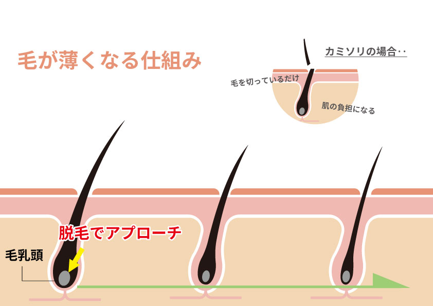 ヒゲ脱毛直後におきる泥棒ヒゲについて｜【公式】メンズリゼのヒゲ脱毛専門サイト