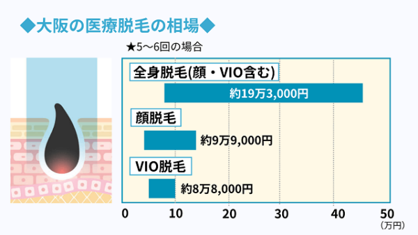 大阪メンズ脱毛サロン #大阪メンズ脱毛 #メンズ脱毛サロン