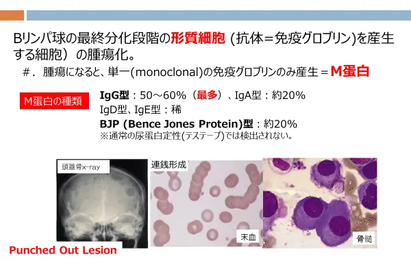 6/7㈮受診日〜６月いろいろ | 私の中の多発性骨髄腫