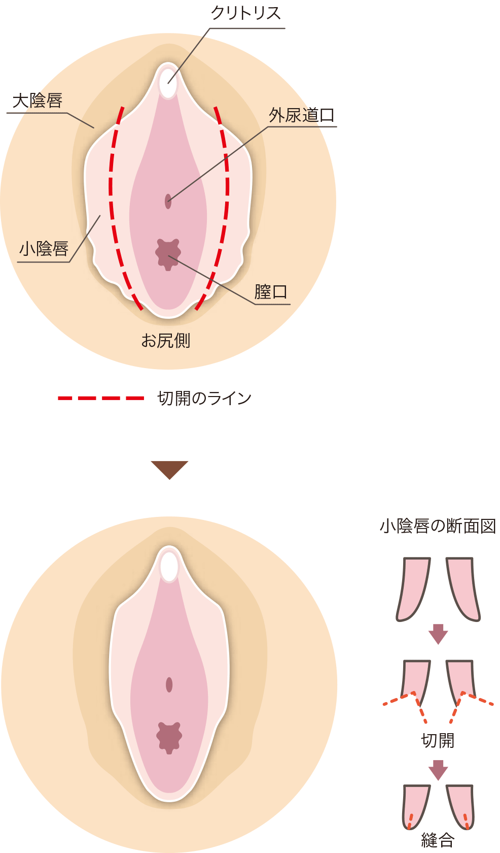 恥垢とは？溜まりやすくなる原因と治療法の解説 | コラム一覧｜