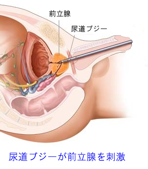 尿道オナニーという悪魔の果実 - 生涯現役！オトコ塾！！