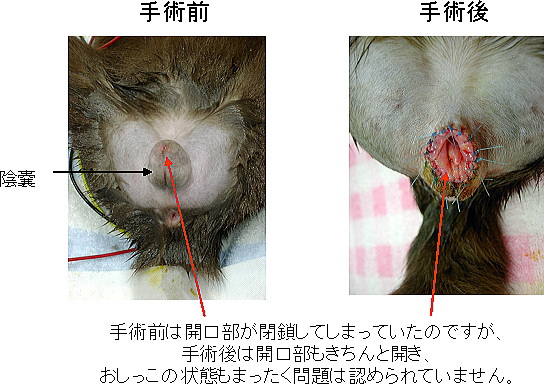 【真性包茎とカントン包茎、手術をする理由】