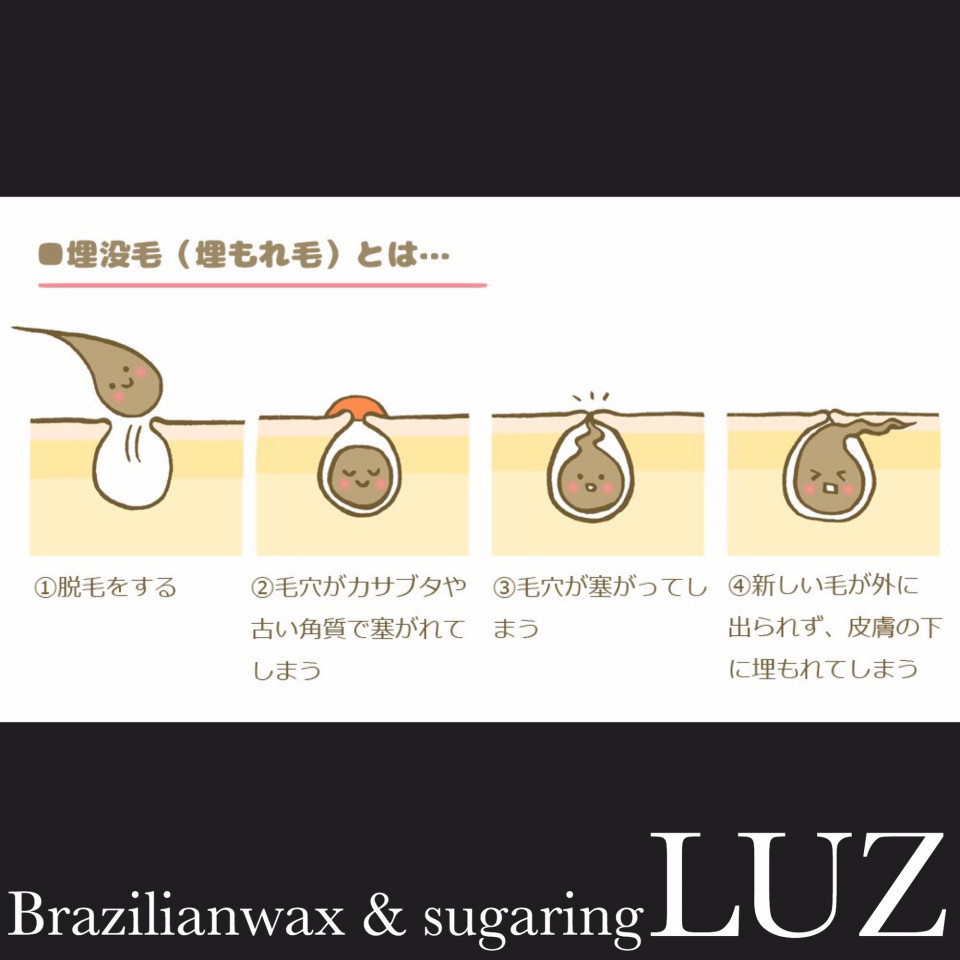 ハイドラフェイシャル本当にお勧め | 高崎市でブラジリアンワックス脱毛サロンをお探しの方に役立つ情報