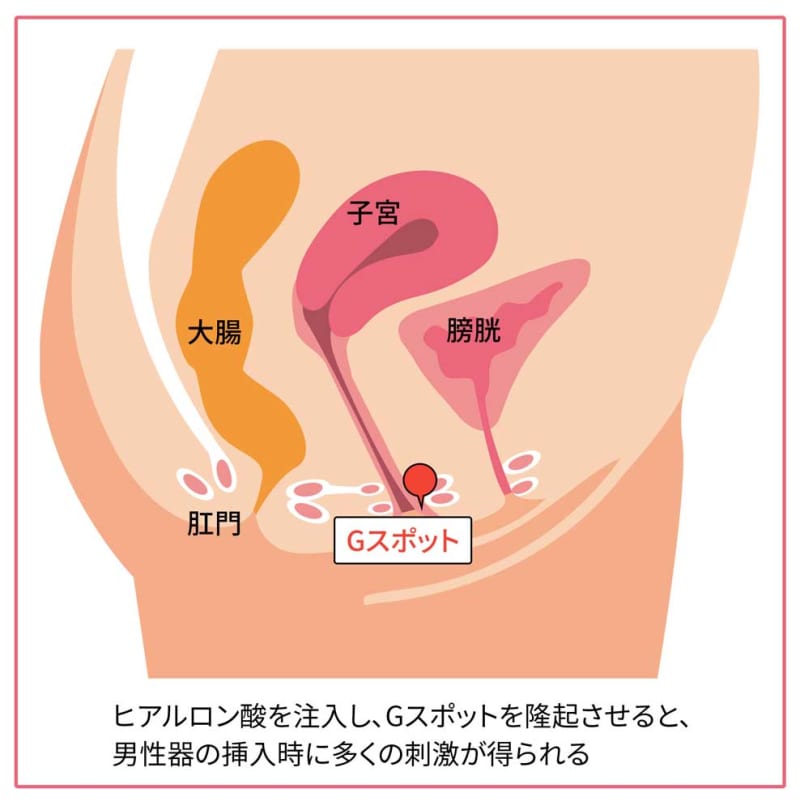 中イキとは？ 中イキできない理由と中イキするための方法【医師が解説】｜「マイナビウーマン」