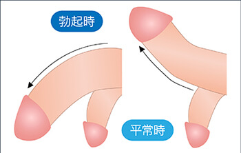 希少な「ペニスみたいな植物」を摘む女性たちに対しカンボジア政府が激怒 - GIGAZINE