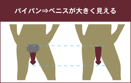 男性がパイパンにする陰毛処理のやり方を紹介 | メンズ脱毛百科事典