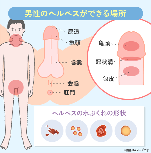 睾丸・キンタマが痛い（精巣の痛み）｜川崎市麻生区のもちづき泌尿器科クリニック｜柿生駅徒歩1分