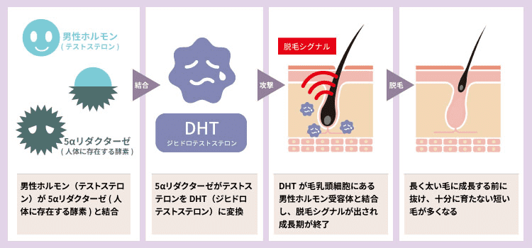 オナニーでしか射精できない「マンガ」【浜松町第一クリニック】