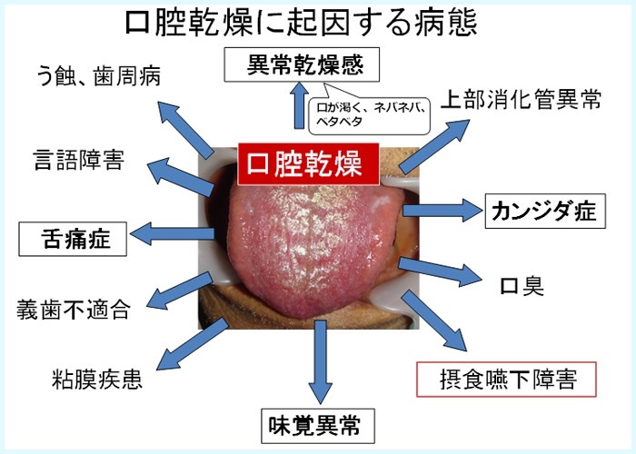 センタータンの開け方・位置や痛みなど舌ピアスの基礎知識 | ボディピアス凛｜軟骨ピアスまとめ