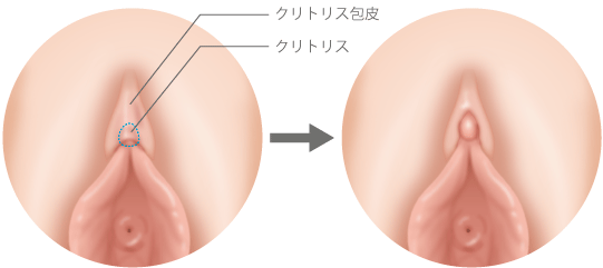 性知識イミダス：女性の生殖器を知ろう②外性器 | 連載コラム |