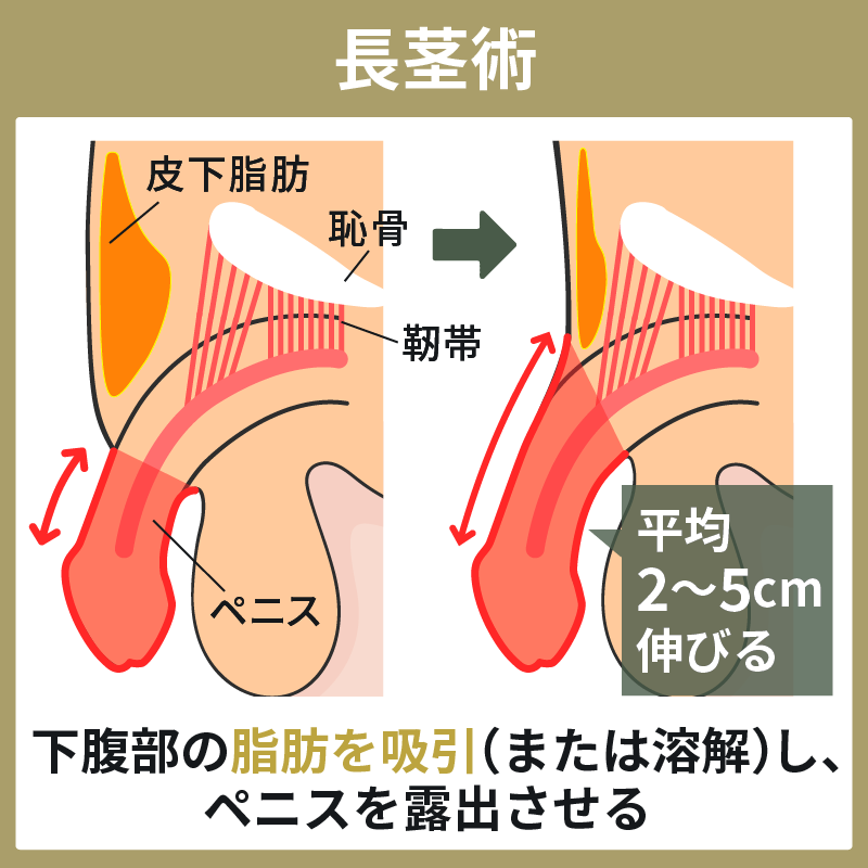 喜国雅彦＆国樹由香 on X: 