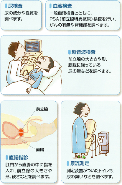 電マを使った前立腺オナニーのやり方！最強のドライオーガズムで昇天