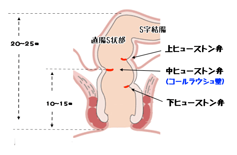 S状結腸(エスジョウケッチョウ)とは？ 意味や使い方 - コトバンク