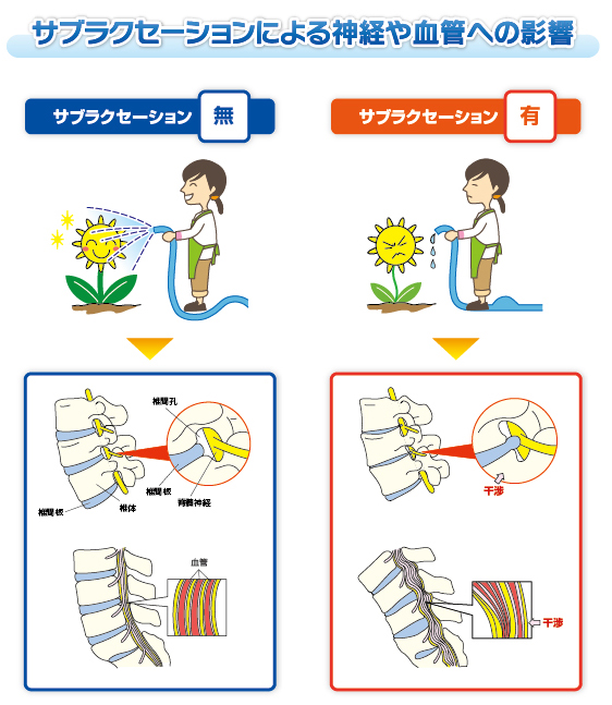 肩インピンジメント症候群の基礎知識と運動×機能解剖学 ｜ XPERT