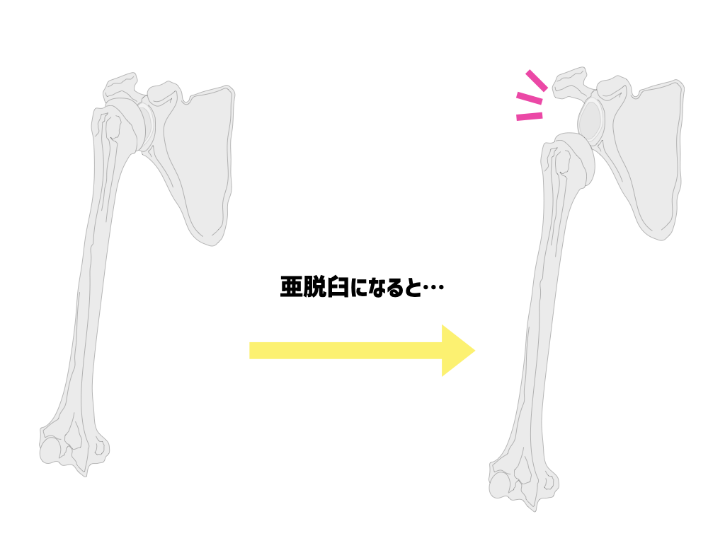 ツクダカイロプラクティックセンター｜真性脊椎変位｜クライアント（利用者）専用カイロプラクティック説明ホームページ